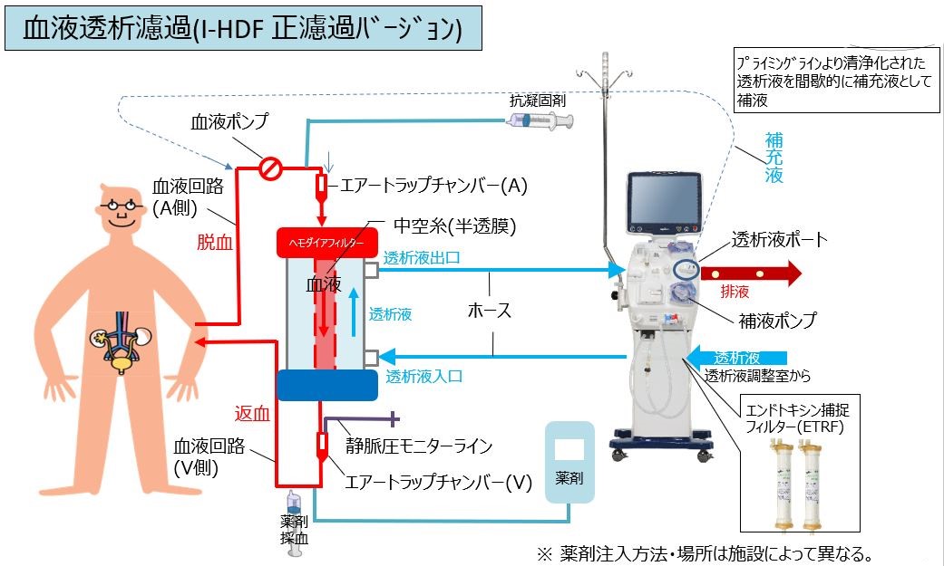 【画像】I-HDF画像