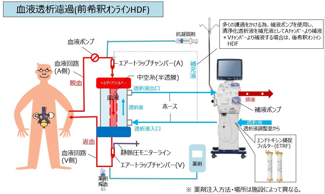 【画像】オンラインHDF